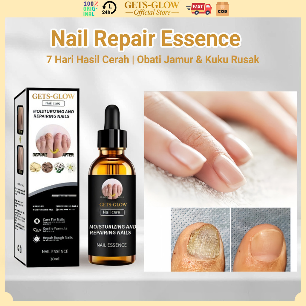 GETS-GLOW Nail Repair Essence 30ml Obat Jamur Kuku & Perawatan Kuku Rusak – Anti Jamur, Antibakteri,