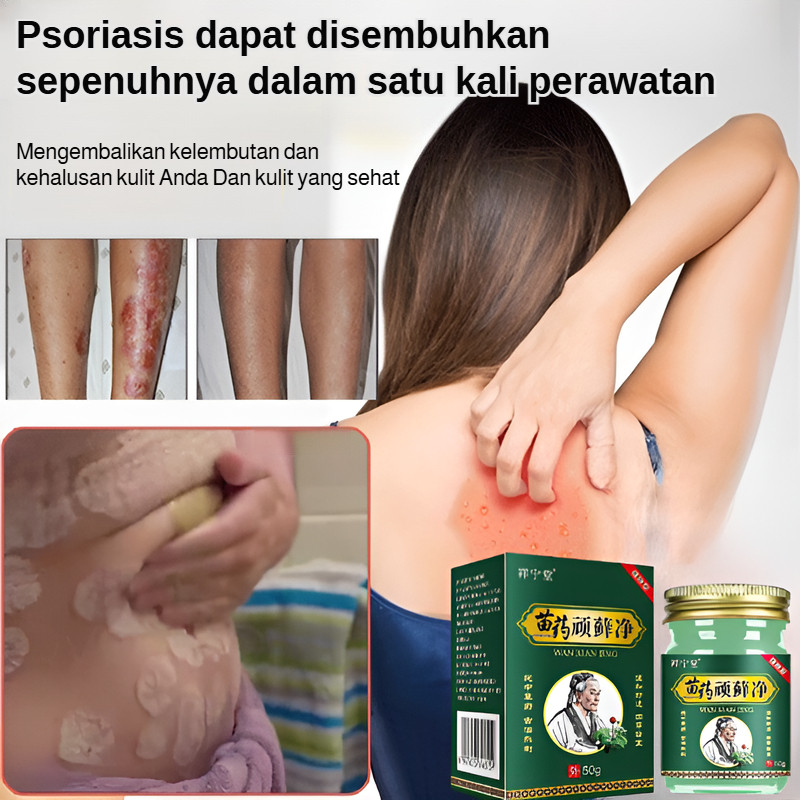 Cleansing Cream Effective Root Cure Eczema Antibacterial Ointment Cleansing Cream Reuse Cleaning