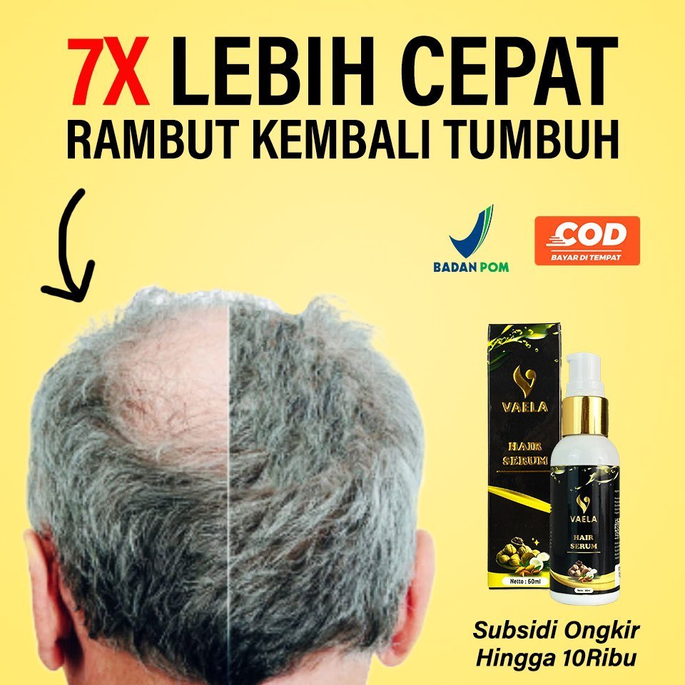 [ Promo ] || Vaela Hair Serum Penumbuh Rambut Serum Rambut Pencegah Kebotakan Melebatkan Rambut BPOM