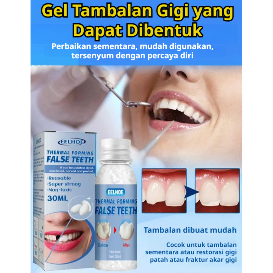 Tambalan Gusi Berbentuk | Tambalan Gel Untuk Celah Dan Gigi Berlubang | Restorasi Gigi