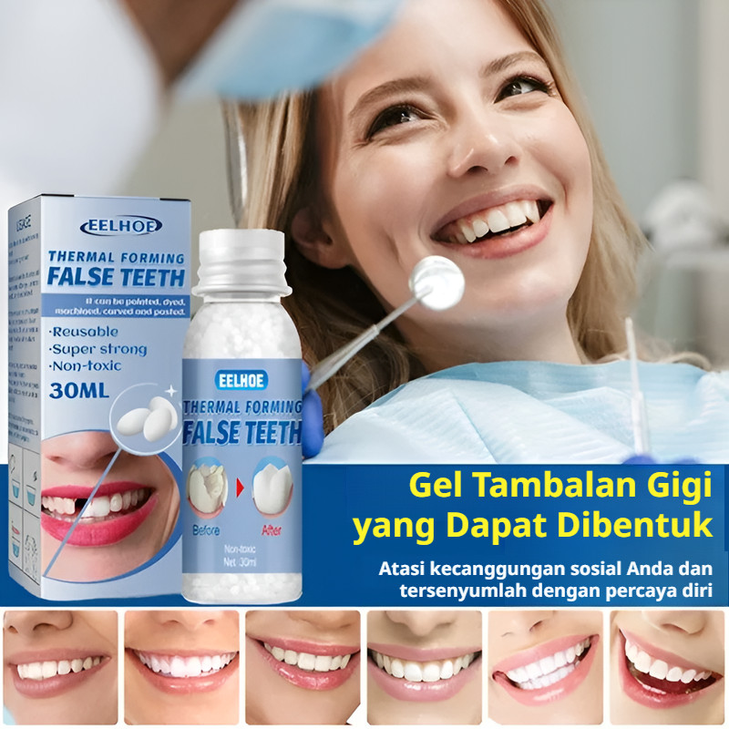 Tambalan Gusi Berbentuk | Tambalan Gel Untuk Celah Dan Gigi Berlubang | Restorasi Gigi