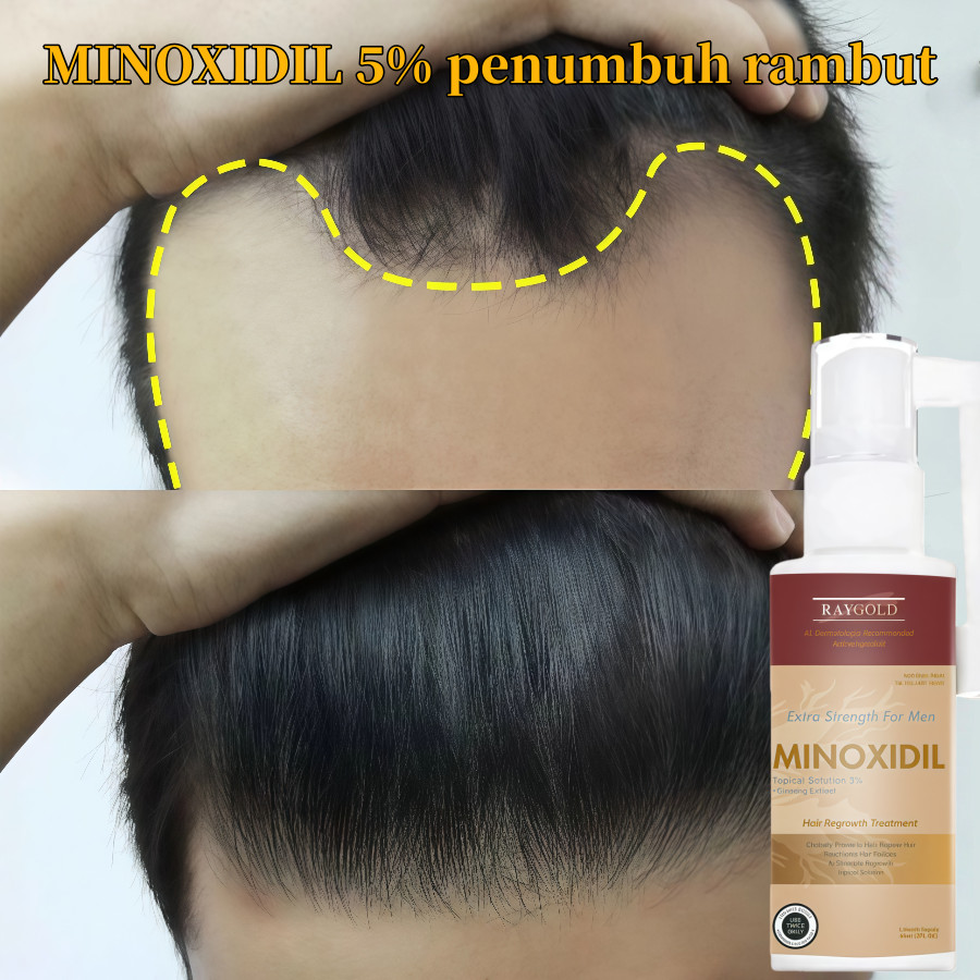 MINOXIDIL5%penumbuh rambut & brewok with Ginseng extract for MEN made in USA - RAYGOLD - MINOX MINOK