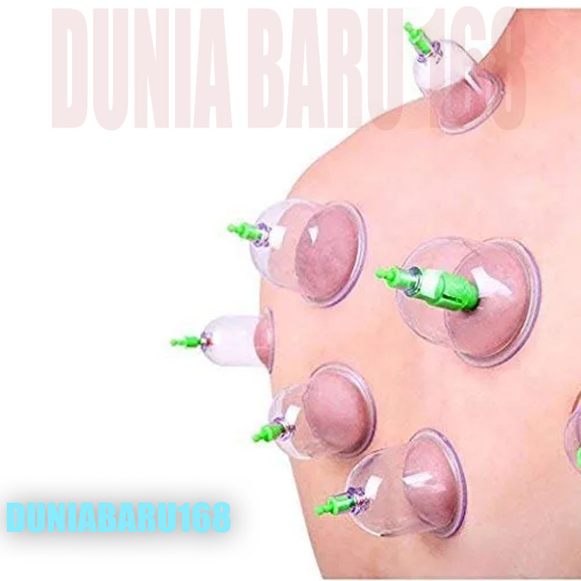 TergacorAlat Bekam / Kop Angin Isi 12 / Alat Bekam isi 12 / alat Kop angin lengkapTerbaik