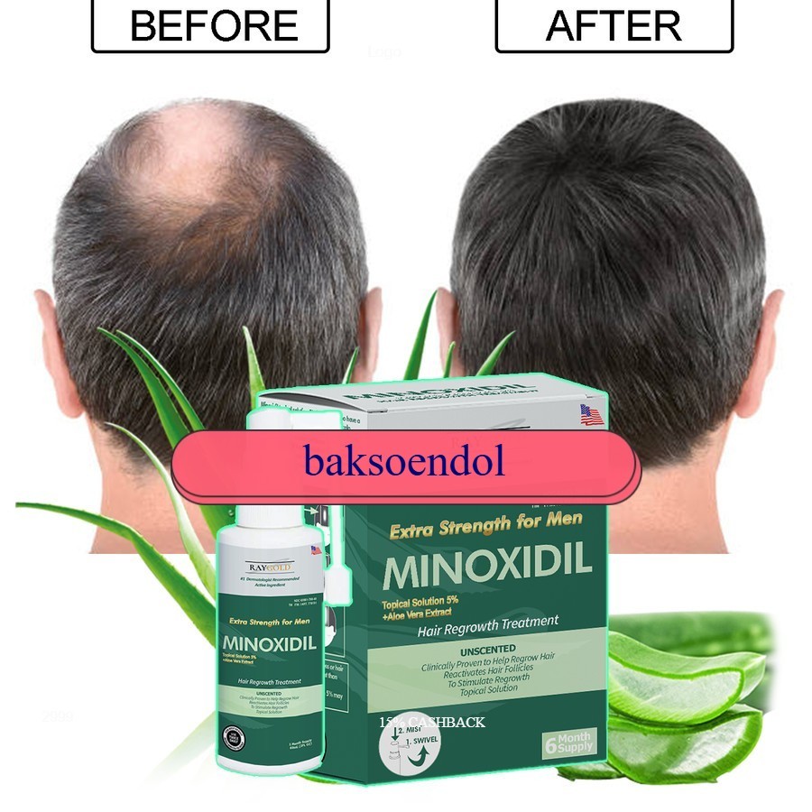 MINOXIDIL 5% penumbuh rambut & brewok with Aloe Vera for MEN made in USA - RAYGOLD - MINOX MINOKSIDI