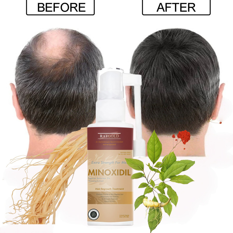 MINOXIDIL5%penumbuh rambut & brewok with Ginseng extract for MEN made in USA - RAYGOLD - MINOX MINOK