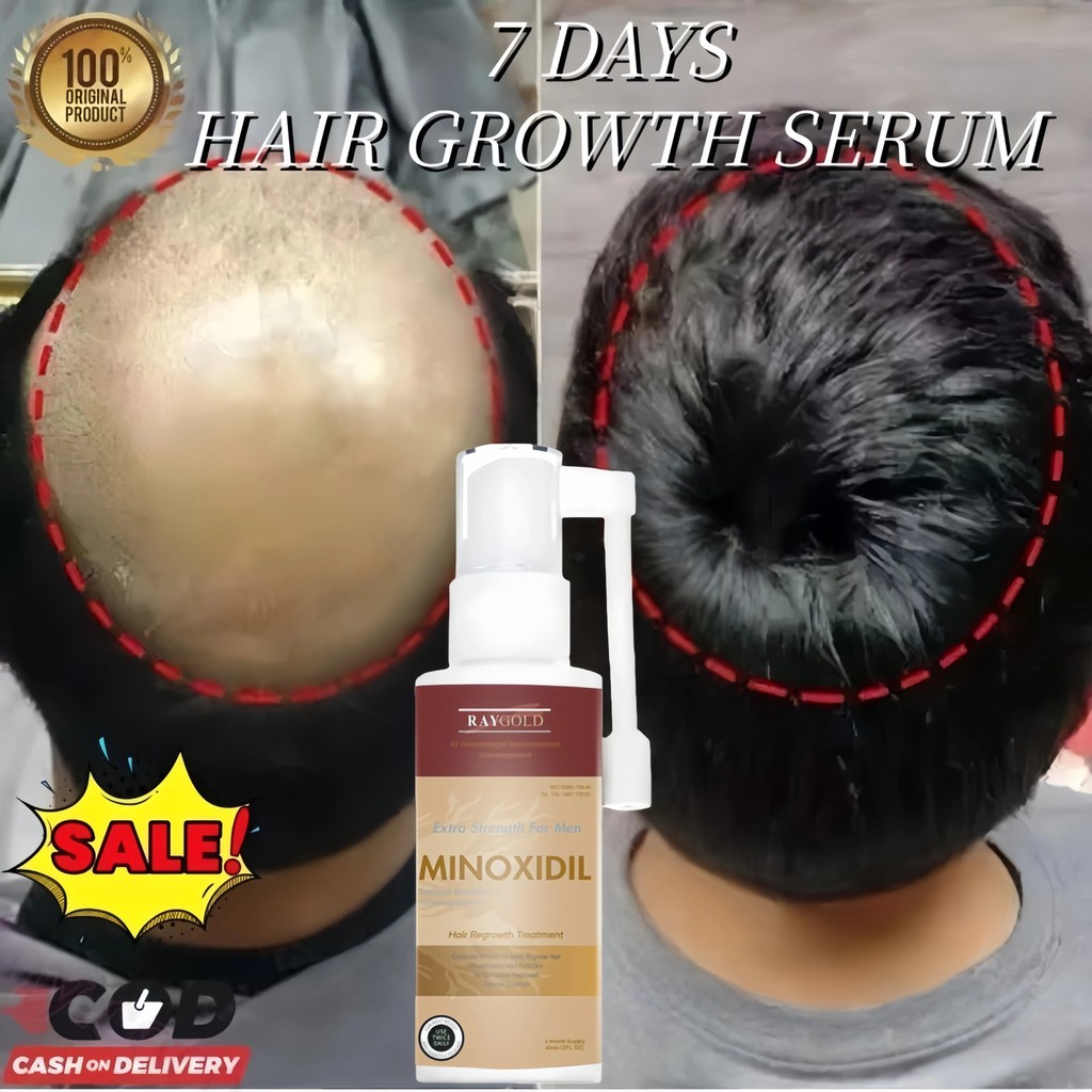 MINOXIDIL 5%for MAN penumbuh rambut with Ginseng extract from USA - RAYGOLD - MINOX MINOKSIDIL anti 