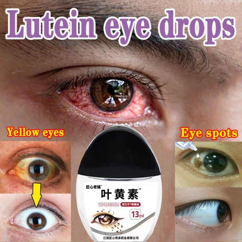 Tetes Mata Lutein Lutein eye drops 13ml Khusus untuk mata kuning dan bercak di mata Baik untuk anak-