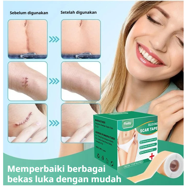 Plester Bekas Luka Perekat - Untuk Perbaikan Bekas Luka, Stretch Mark, Bekas Luka Bakar, Bekas Luka 