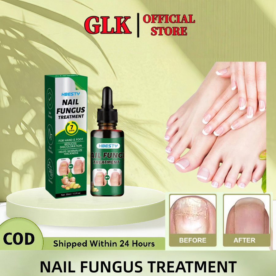 GLK-Serum kuku jamur dan rusak obat kuku jamur dan rusak obat jamur kuku 30ML obat kuku rusak paling