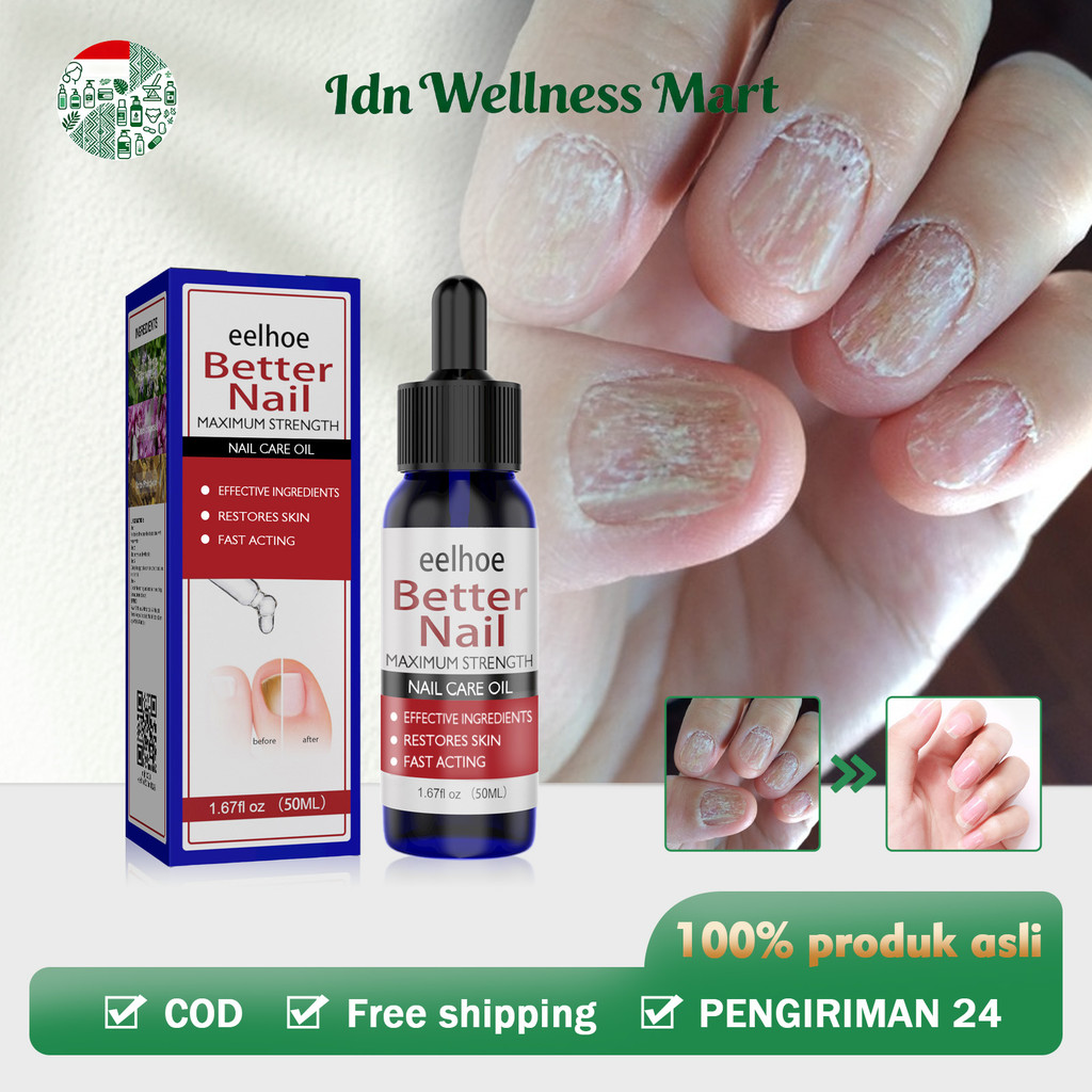 EELHOE Serum Kuku Jamur Dan Rusak 50ml Obat Kuku Jamur Dan Rusak Obat Jamur Kuku Obat Penumbuh Kuku 