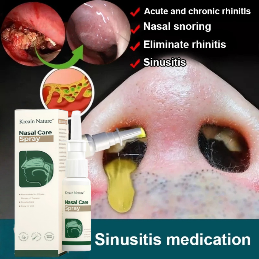 Nasal Spray Semprotan Hidung Obat Polip Hidung Air laut fisiologis Rhintis Spray Obat Sinus Spray Si