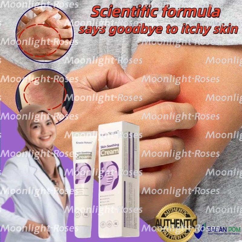 Salep Gatal Paling Ampuh 20g Anti Jamur Gatal Gatal Seluruh Badan Obat Gatal Kulit Salep Eksim Gatal