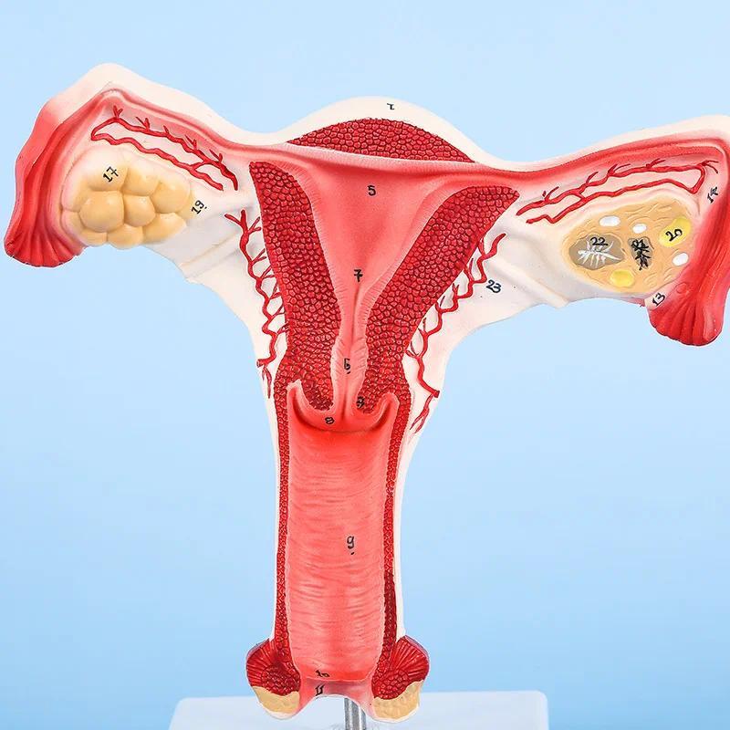 Human Uterus & Ovary Anatomy Model, Female Reproductive System Internal Structure