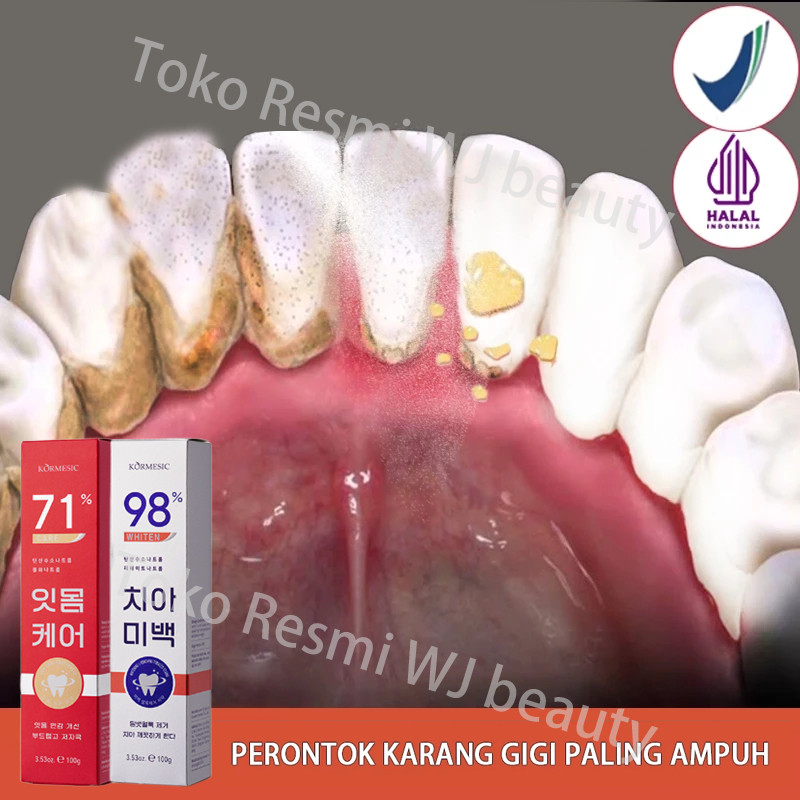 Pasta Gigi Perontok Karang Gigi Pasta Gigi Pemutih Gigi Odol Pemutih Gigi Dan Karang Gigi Pasta Gigi