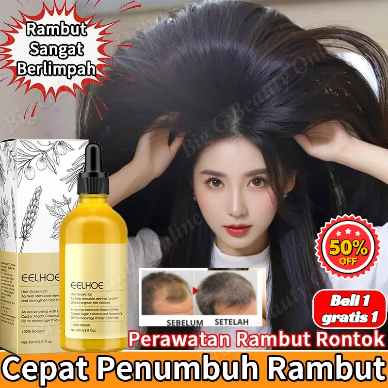Alami/Anti Rontok/Nutrisi/Lembut/Perbaikan SL Minyak Rambut Rosemary Alami Pelembut Rambut/Minyak Ra