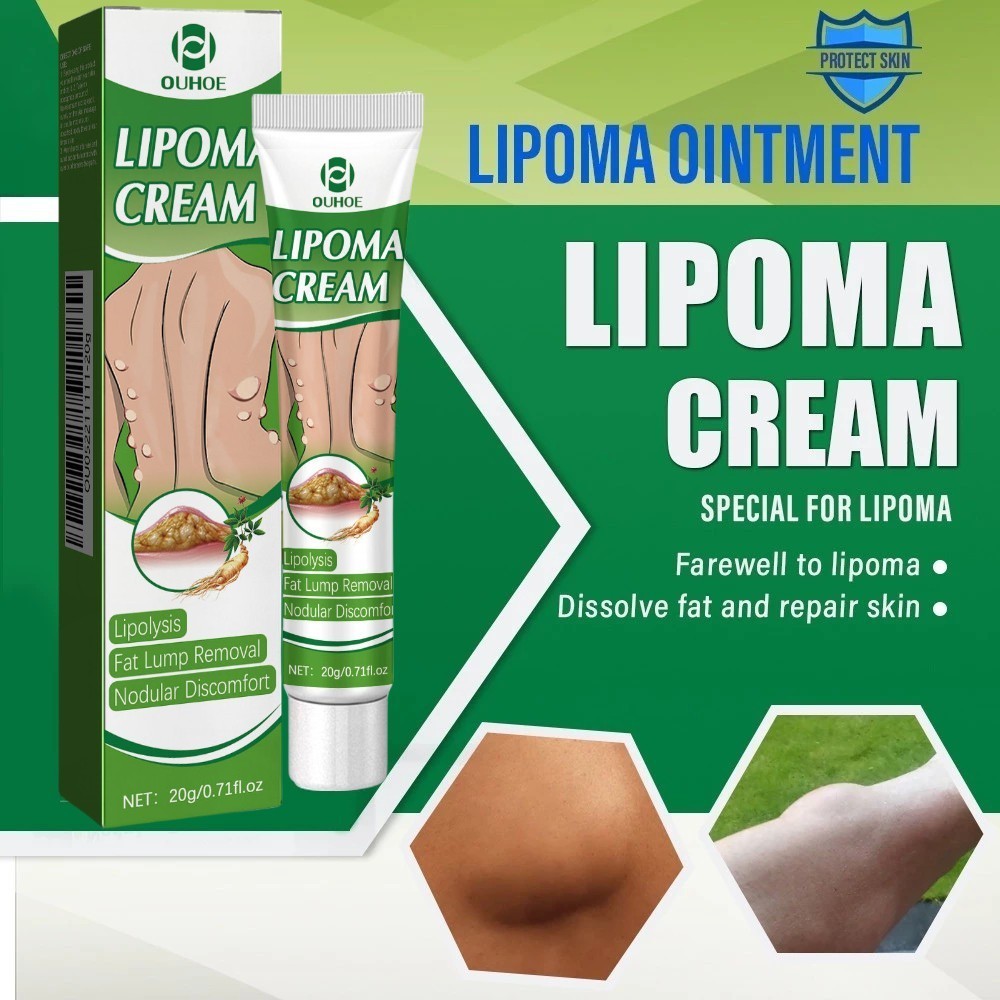 Lipoma Cream Obat Benjolan Subkutan Lipoma Removal Cream Obat Salep Benjolan Lipoma Ampuh Herbal sal
