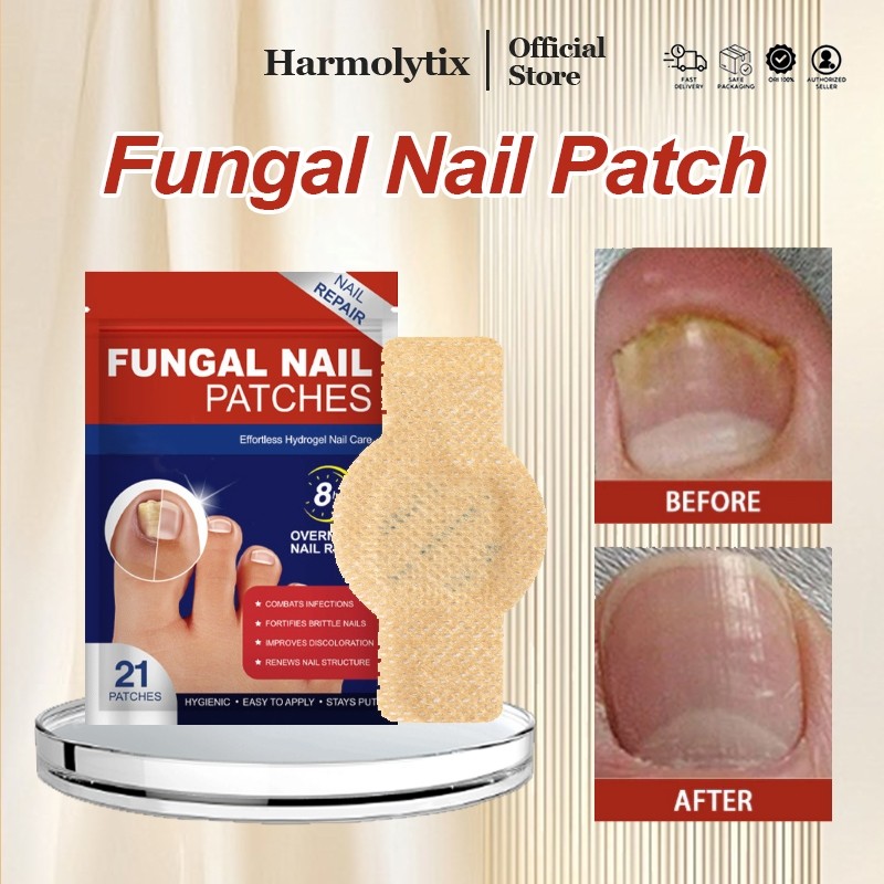 Obat Jamur Kuku Obat Cantengan Obat Kuku Rusak Pembersih Kuku Kaki Hitam Fungal Nail Treatment Funga