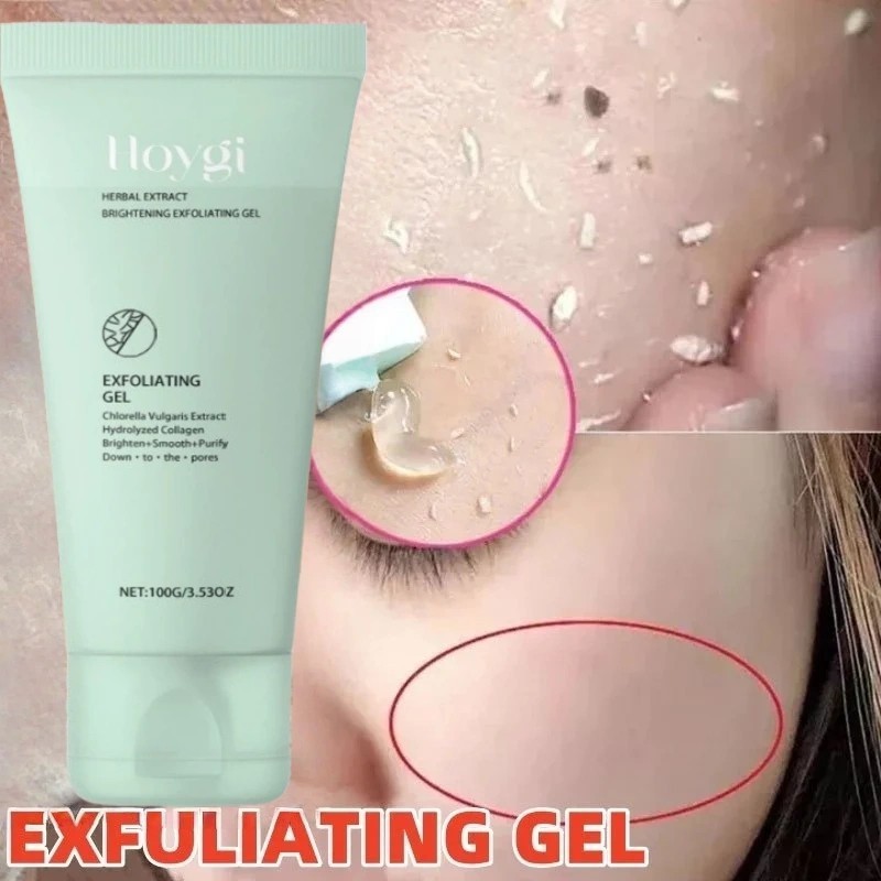Gel Pengelupas Sel Kulit Mati untuk Wajah Glowing - Hoygi dengan Chlorella Vulgaris, Angkat Komedo &