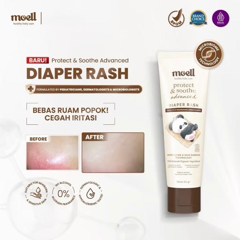 MOELL DIAPER RASH ADVANCED 50GR KRIM UNTUK REDAKAN DAN CEGAH RUAM POPOK Bayi Newborn Persiapan Kelah