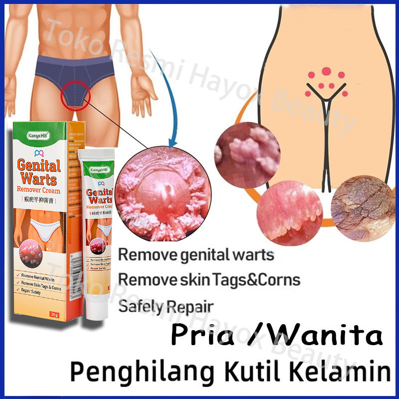 Obat kutil kelamin Pria / Wanita Penghilang Kutil Kelamin Obat Kutil Kelamin HPV  Penghilang kutil d