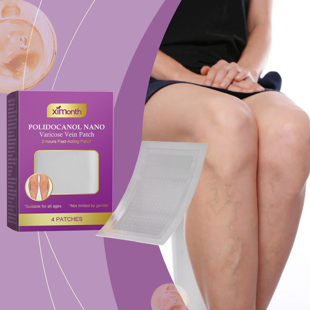 Varises / Koyo Varises / Varicose Patch / Varicose / Penghilang Varises herbal varicose veins patch 