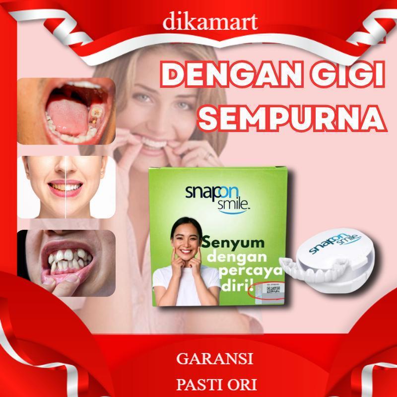 PALING VIRALL Snap On Smile Veneer Vener Venner Veener Venerr Viner Alat Silikon teeth whitening Sna