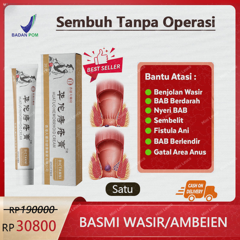 Obat wasir Salep wasir Salep ambeien paling ampuh 20g Ekstrak herbal untuk menghilangkan ambeien Was