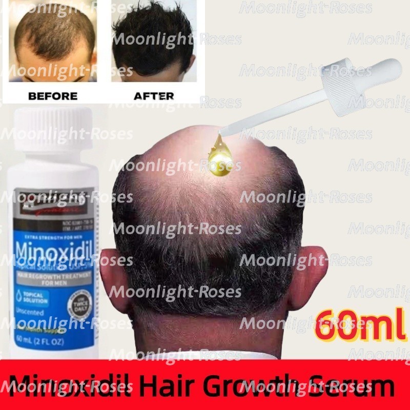 Hair Growth Serum 60ml Original | Serum Penumbuh Rambut Botak & Rontok | Fast Hair Growth Essence Ob