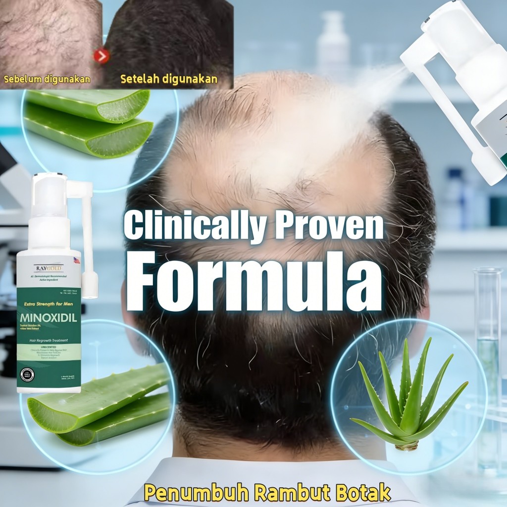 Perawatan pertumbuhan rambut cepat, pertumbuhan rambut cepat, perawatan pencegahan rambut rontok, se