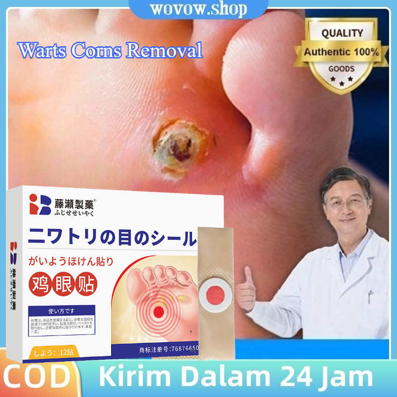 Koyo Kaki Ampuh Jepang Asli 12pcs Corn Patches Plester Penghilang Kutil Kapalan Mata Ikan Cepat Semb