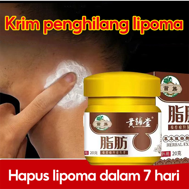 Beli 1 Gratis 1/Kirim Dalam 24 Jam Krim Penghilang Lipoma/Salep Benjolan Salep Lipoma Paling Ampuh/L