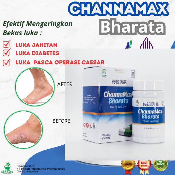 OBAT PENGERING LUKA OPERASI/OBAT LUKA JAHITAN/OBAT DIABETES/OBAT CINA PASCA OPERASI CAESAR/ CHANNAMA