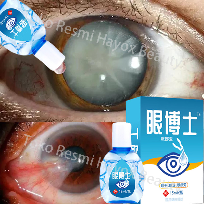 Obat Tetes Mata Obat Mata Katarak EyeDrop Obat Mata Buram Obat MataBerlemak Tetes Mata Herbal Mata K