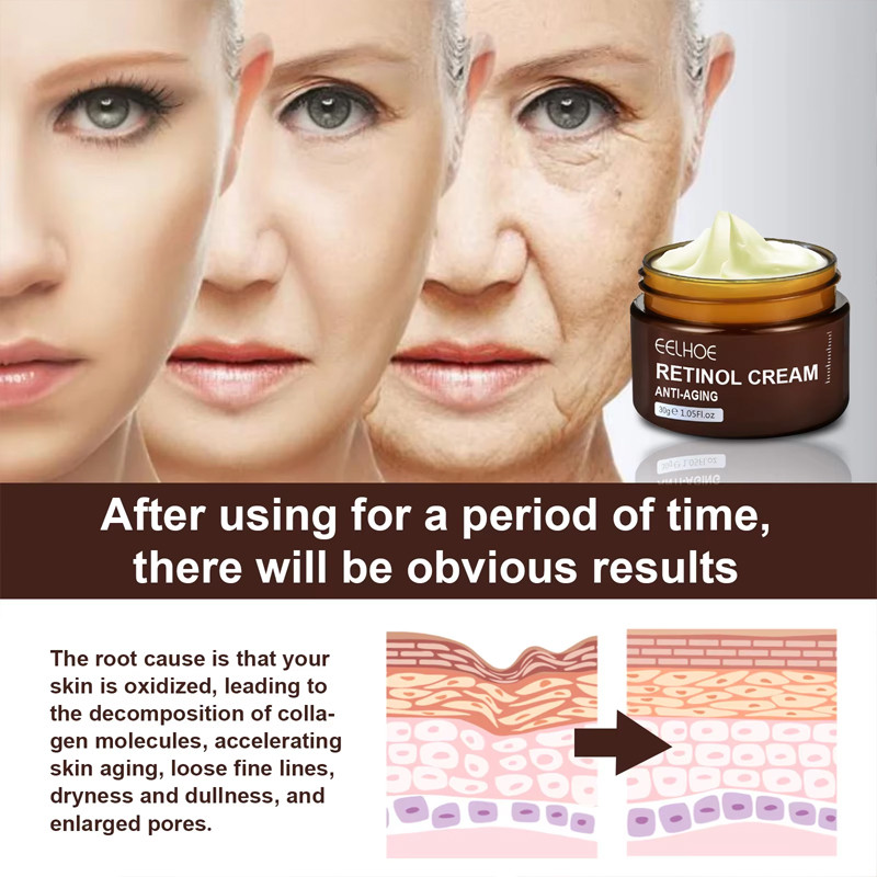 Retinol Wrinkle Remover Face Cream Firming Lifting Anti Aging Fade Fine Lines Moisturizing Whitening