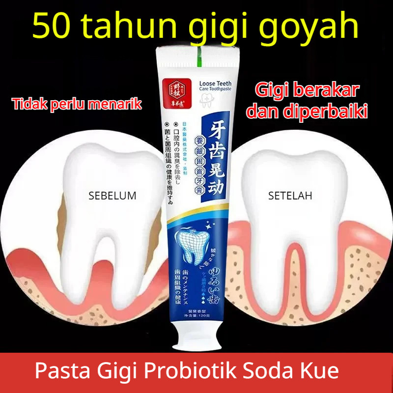 Krim Perawatan Mulut Pasta Gigi Untuk Gigi Goyang Produk Kesehatan Mulut Abadi Produk Perawatan Mulu