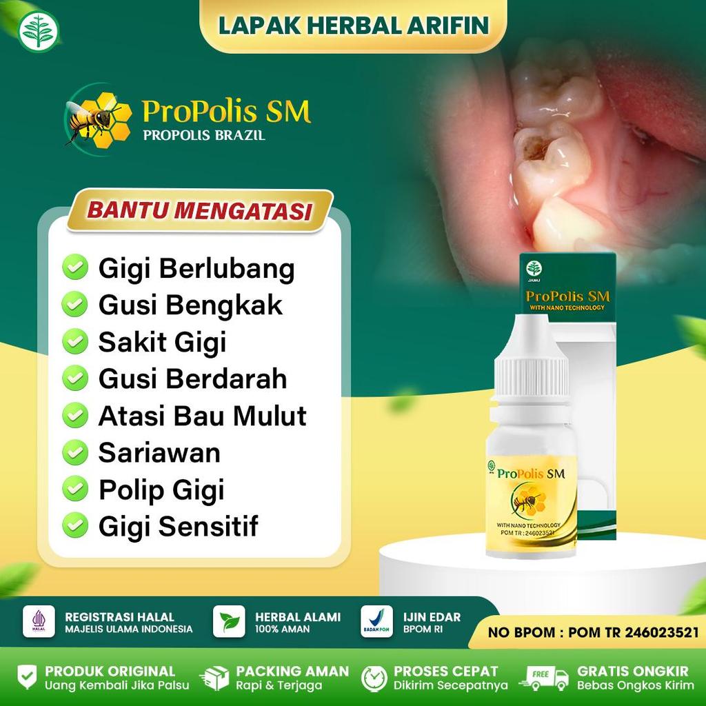 Propolis SM Obat Gigi Berlubang, Sakit Gigi Berlubang