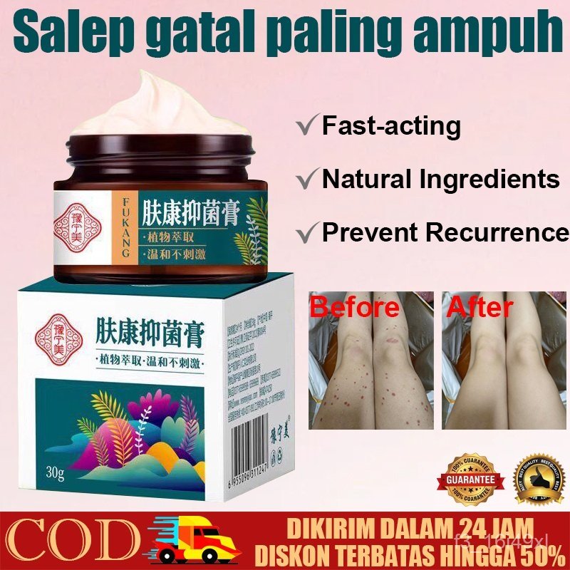 Salep gatal paling ampuh & cepat sembuh | Obat gatal eksim kudis kutu air panu jamuran | Salep kulit