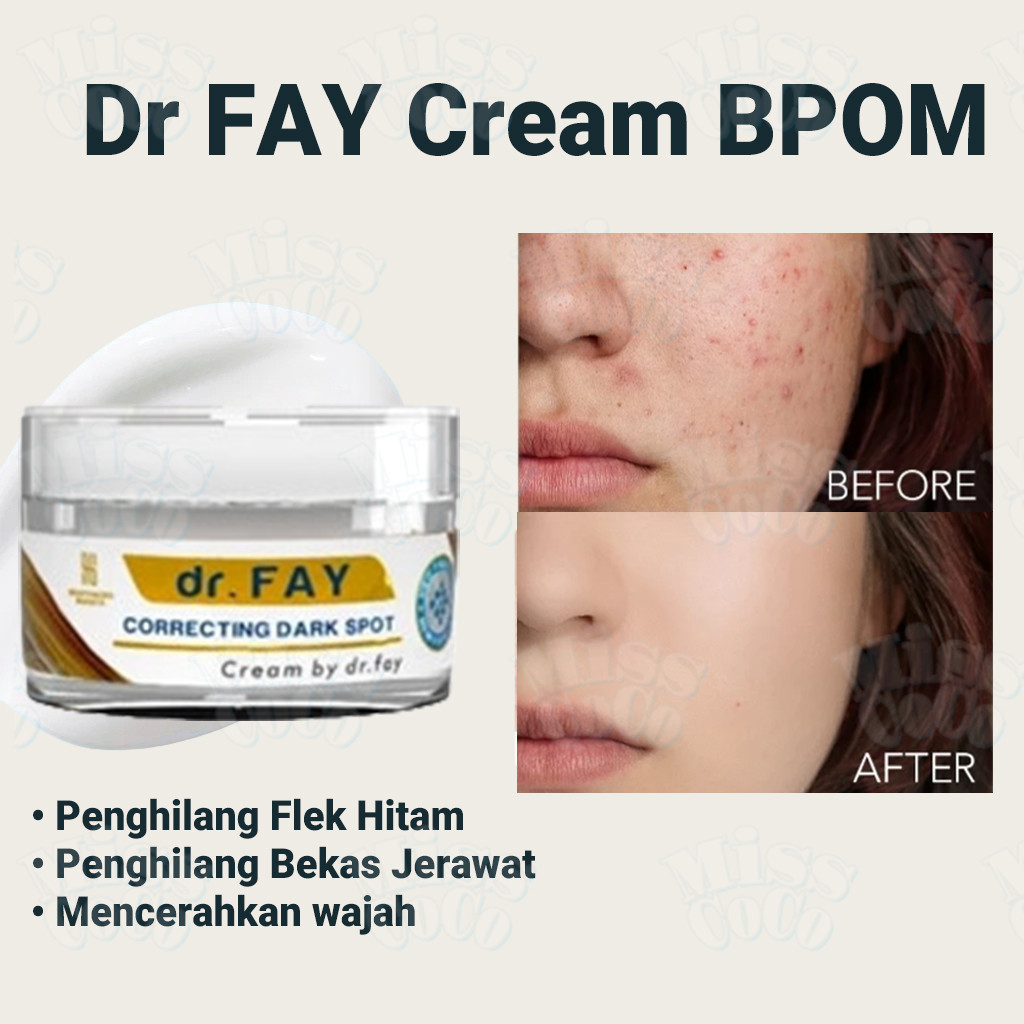 Dr FAY Cream 10g Original BPOM – Penghilang Flek Hitam & Bekas Jerawat, Memudarkan Dark Spot Memband