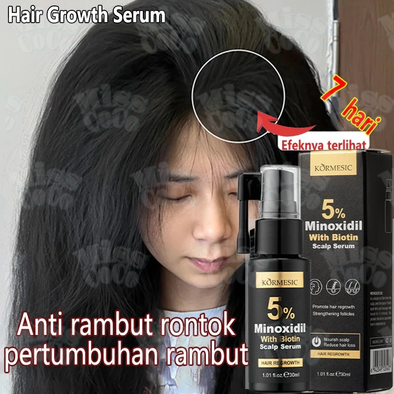 Penumbuh Rambut Minoxidil Serum Penumbuh Rambut dengan Minoxidil 5% dan Biotin untuk Atasi Botak dan