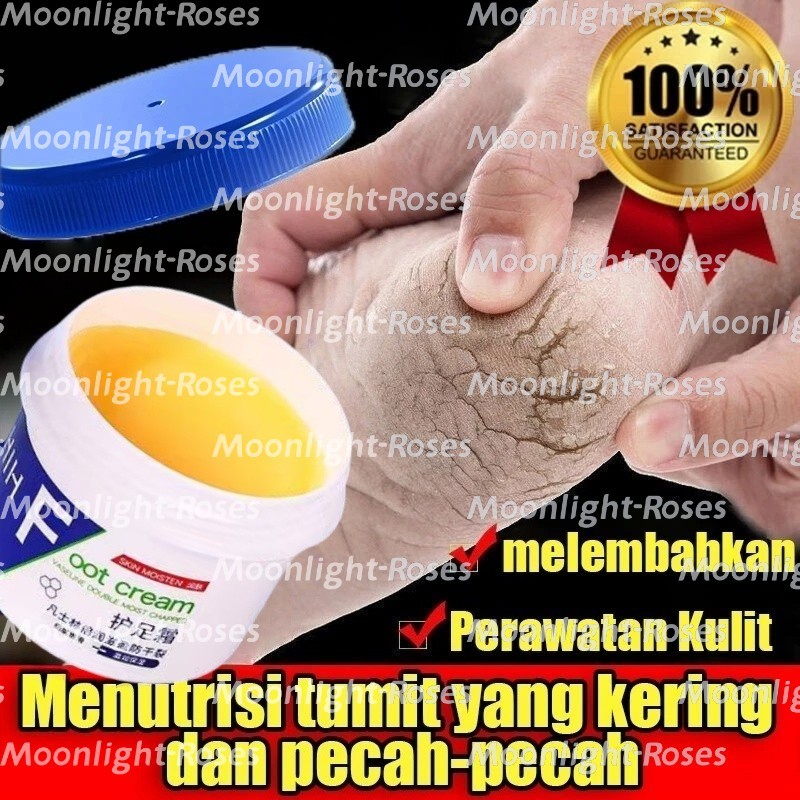 kaki pecah dan kering Foot cream Obat kaki pecah Pelembab kaki kering dan pecah Penghalus kaki kasar