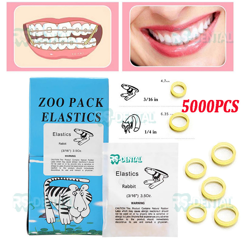 5000pcs/box karet elastik gigi ortho behel dental rubber band elastis karet elastic bands kawat gigi