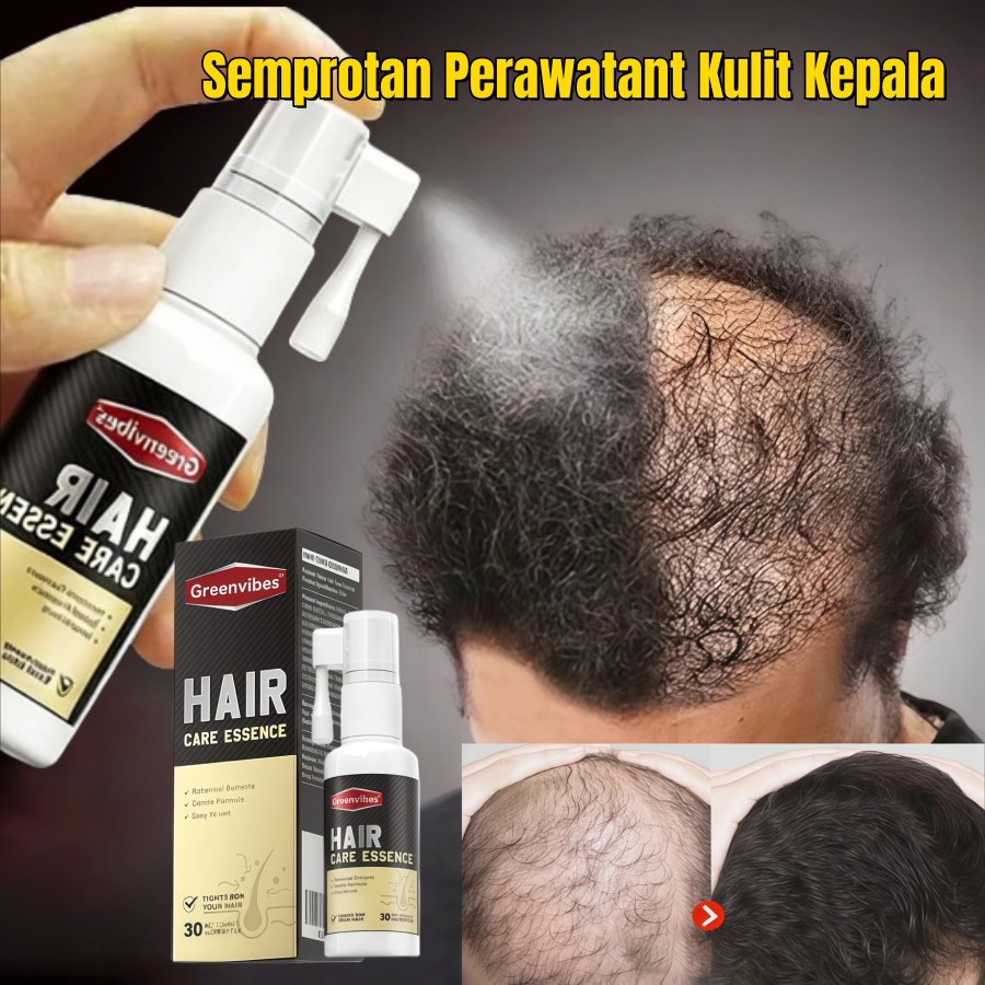 Hair Essence 30ml Serum Rambut Rontok Pria Wanita, Solusi Rambut Tipis, Botak, Jidat Lebar Tampak Pe