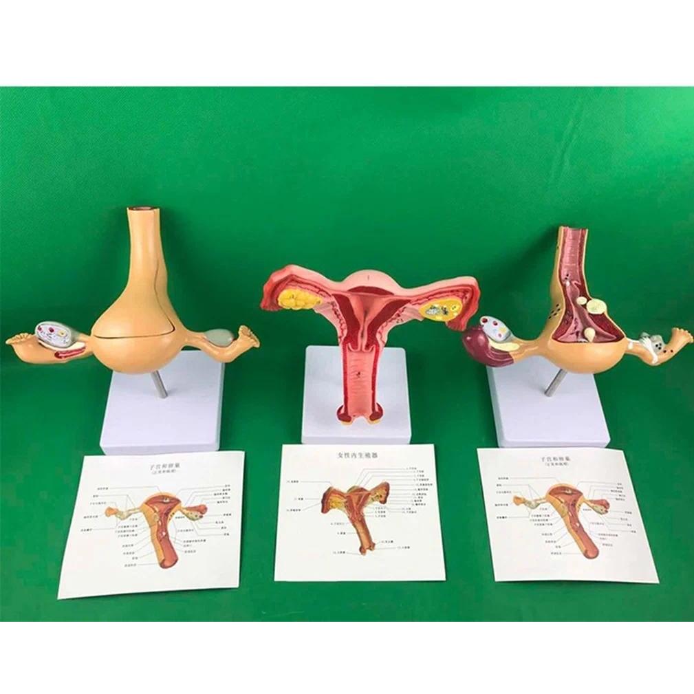 Ovary and uterus sease ssection model Pathology Female uterus model teaching human mecal aids anatom