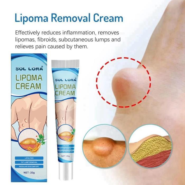 Obat Benjolan Lipoma Salep Benjolan Tiroid Cream Penghilang Lipoma Herbal 20g Krim Lipoma cream Obat