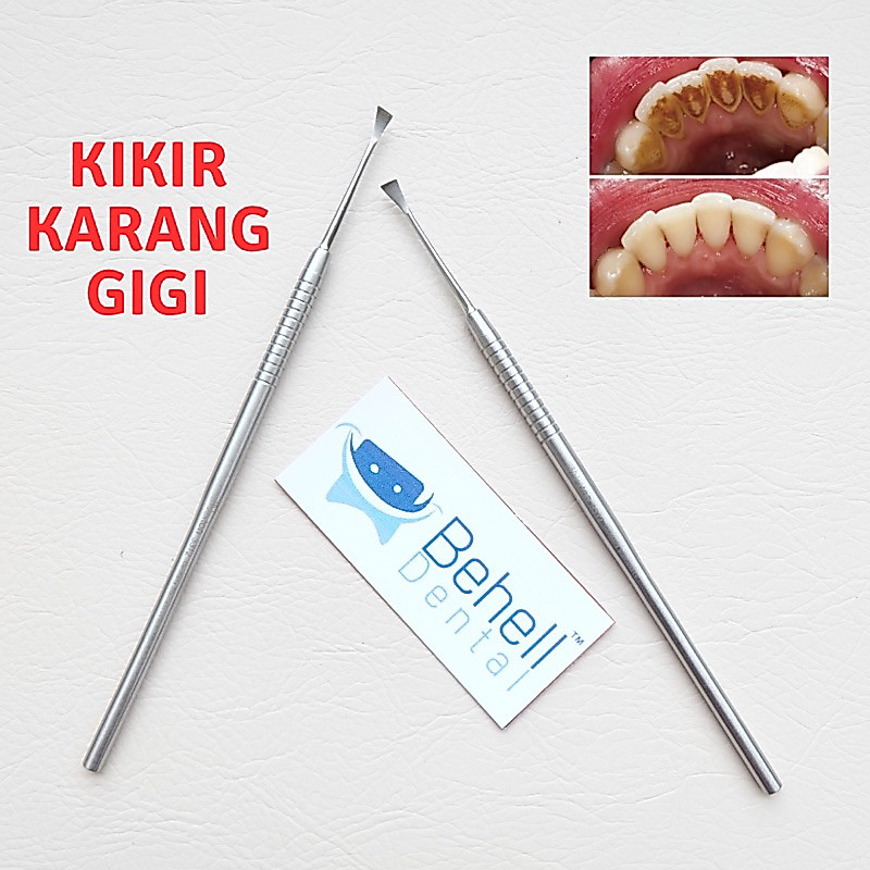 ALAT KIKIR KARANG GIGI MANUAL 1 SISI - Anti Karat Penghilang Pembersih Plak Gigi Ampuh - Penghilang 