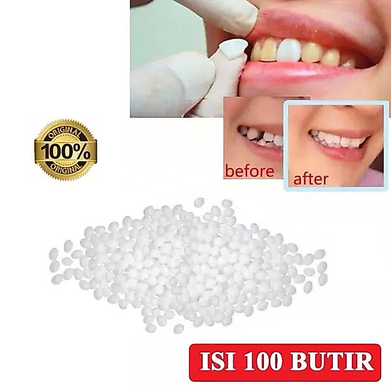 [ PAKET ISI 100 BUTIR ] BUTIR Penampal Gigi sementara temptooth BUAT GIGI PALSU SENDIRI GIGI PALSU S