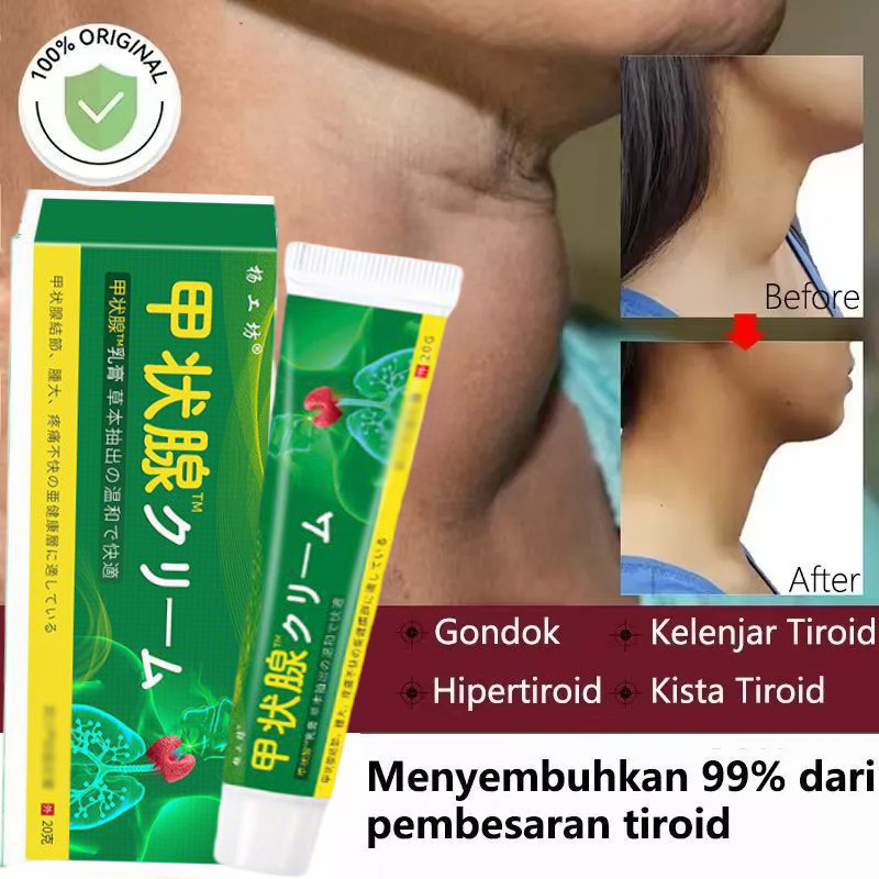 Salep Tiroid Obat Benjolan Di Leher Obat Gondok 20g Benjolan Dileher Tumor Kelenjar Tiroid Lipoma