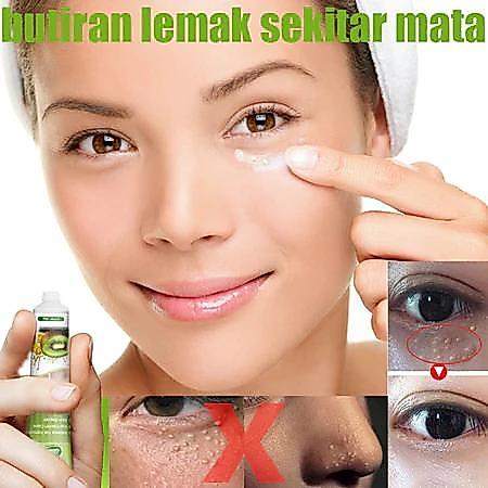 Krim Penghilang Milia Obat Milia Di Bawah Mata Cream Vitamin E Eye Cream Penghilang Milia Syringoma