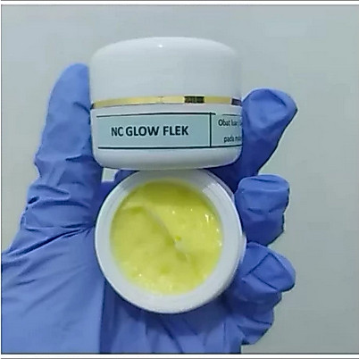 NC Glow flek whitening ampuh hilangkan flek bandel