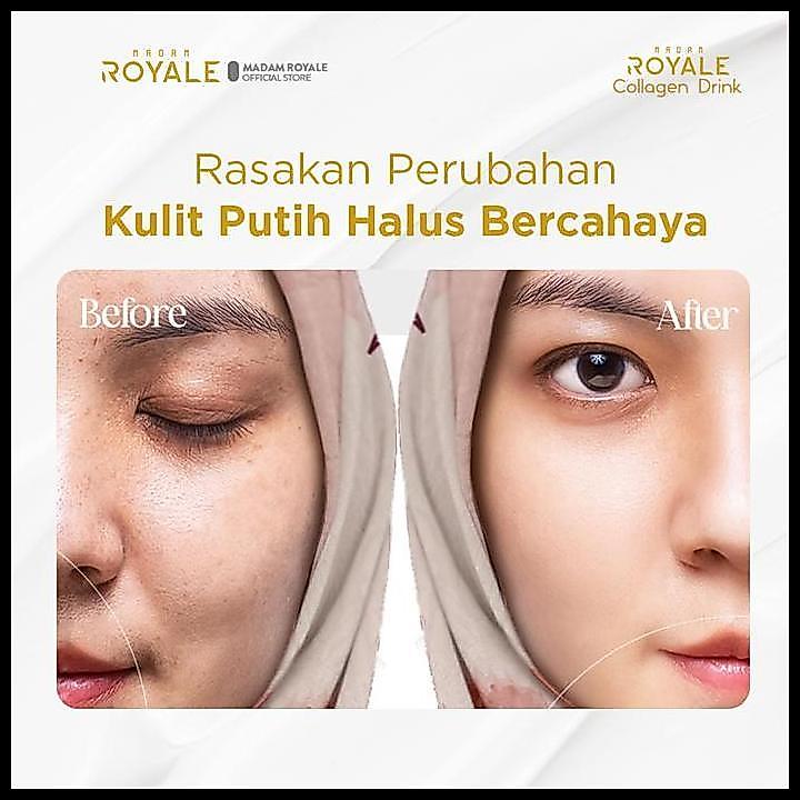 Paket Extra Hemat Madam Royale Collagen Drink | Collagen & L-Glutathione Dosis Tinggi Best Seller